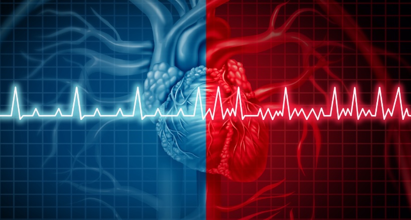 An Israeli startup has developed an innovative method for early diagnosis of coronary heart disease